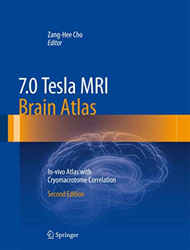 7.0 Tesla MRI Brain Atlas: In-vivo Atlas with Cryomacrotome Correlation