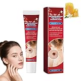 Skin Tags Remover, Wart Removal&Tag Recede Cream, Skin Tag Removal Kit, Fast-Acting Skin Tag & Mole Remover For Hands & BodyFor Common Warts Plantar Warts, Corn And Calluse, Suitable For All Skin Type