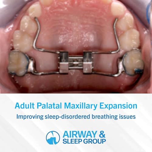 Adult Palatal Maxillary Expansion