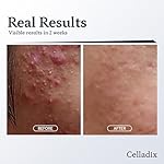 Sebum Rebalancing Rx 131 Ampoule | Minimize Sebum Serum | Tighten Enlarged Pores | Repair Skin Barrier | Rapid Soothing for Daily Use | Oily & Combination Skin | 0.68 Fl Oz - Image 3