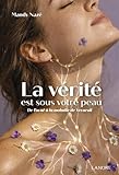  La vérité est sous votre peau ! De l\'acné à la maladie de Verneuil