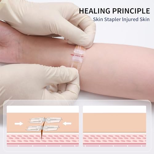 Emergency Wound Closure Device, 4 Pcs Butterfly Bandaids Closure Zippers, Repair Wounds Without Stitches, Quick Clot, Adjustable (4-Strap) - Thumbnail 5