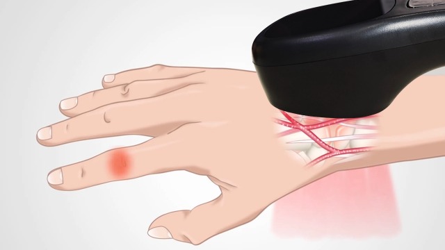 スーパーライザー 家庭用 lllt red light Amazon | スーパーライザー 家庭用 lllt red light 2*808nm 12
