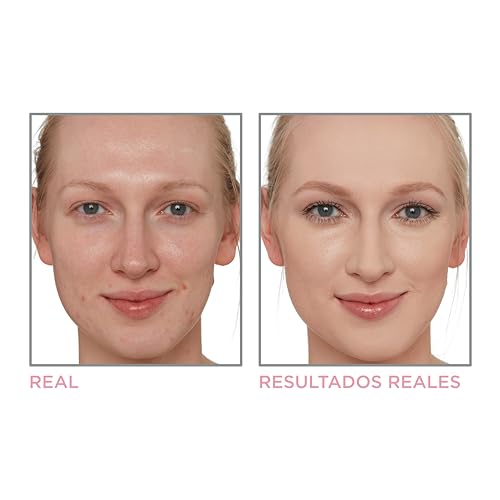 Repelentes, Music Imagen adicional