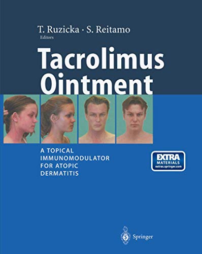 Tacrolimus Ointment: A Topical Immunomodulator For Atopic Dermatitis