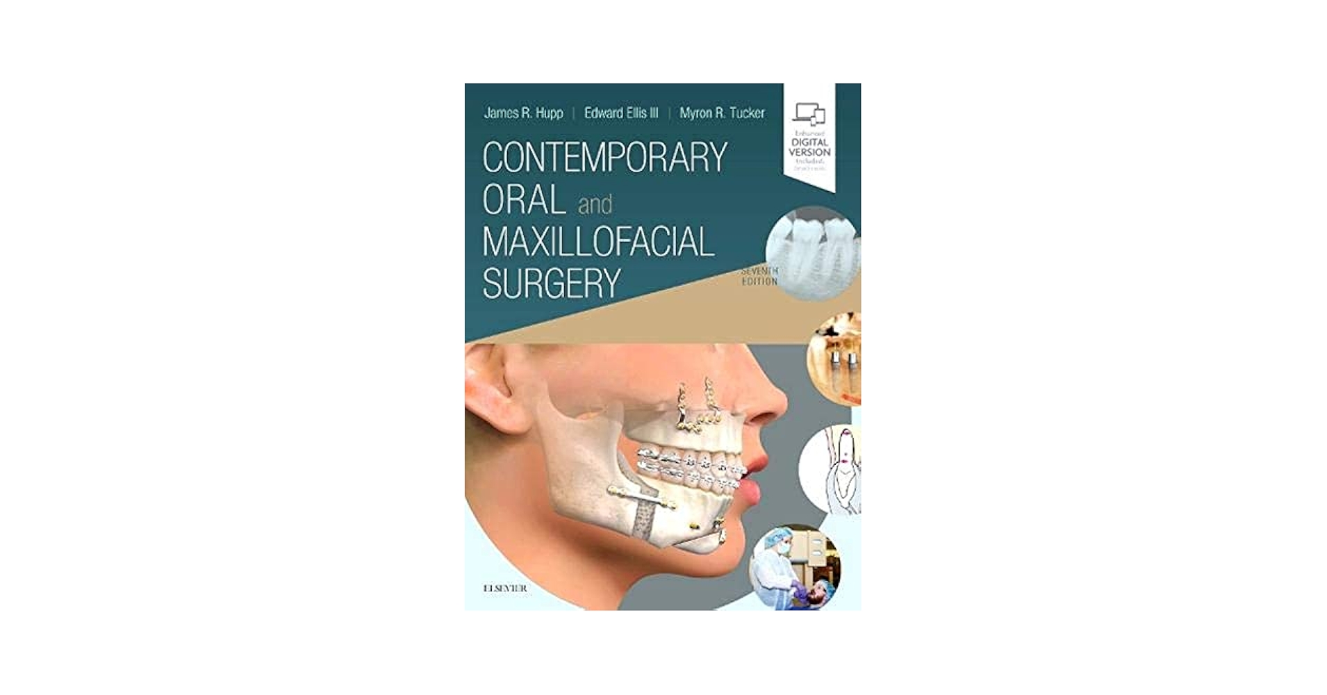 Contemporary Oral and Maxillofacial Surgery: 9780323552219