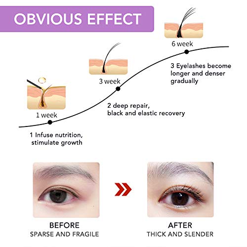 Eyelash Growth Serum, Lash Enhancers & Primers for Eyelash and Eyebrow, Rapid Growing Conditioner Treatment for Thicker, Stronger Lashes and Brow -5ml (Pink)