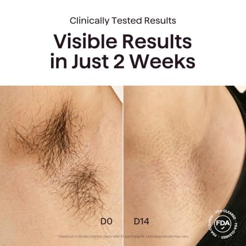 Image of Wavytalk IPL Laser Hair Removal,Bare It with Precision Roller for Full Body