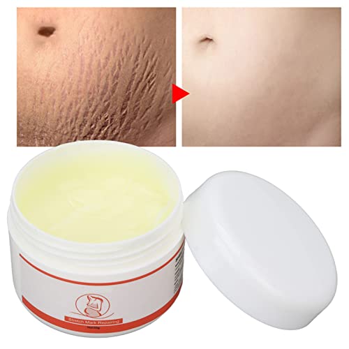 Creme Reparador de Estrias, Prevenir Estrias Fácil de Usar 50g Hidrata Creme Reparador de Linha de C