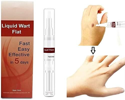 rimozione indolore delle verruche