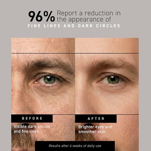 Best Eye Bag Cream for Men Over 50: 11 Products That Actually Work (According to Real Testing) 7 Brickell Men's Restoring Under Eye Cream for Men, Natural and Organic Anti Aging Eye Balm To Reduce Puffiness, Wrinkles, Dark Circles, Crows Feet and Under Eye Bags, 0.5 Ounce, Unscented
