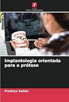 Implantologia orientada para a prótese (Portuguese Edition) 620872239X Book Cover