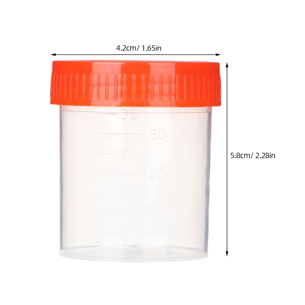 Baluue 100 Piezas Contenedores para Muestras de Heces 40ml con Tapa de Rosca, Frascos de Plástico para Análisis Laboratorio Hospital, Botes Recolección Prueba Médica con Cuchara