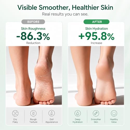 FAMIKYA Urea Cream 40 Percent for Feet Maximum Strength, Foot Cream for Dry Cracked Heels, Callus Remover with 2% Salicylic Acid, Moisturizer for Hands Elbows Knees Rough Skin