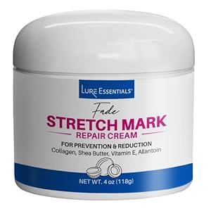 LURE Essentials Fade Stretch Marks Cream – Stretch Marks Remover Cream and Stretch Mark Prevention Cream for Pregnancy…
