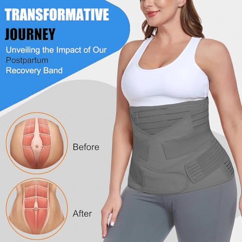 Image of 3-in-1 Postpartum Belt After Delivery - Abdominal Belt for Women Tummy Control | Pregnancy Belts After Delivery | Maternity Belt After C-Section | Abdominal Binder for Post Pregnancy Recovery (Universal) (Beige)