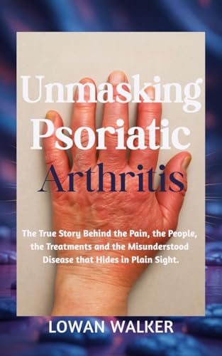 Unmasking Psoriatic Arthritis: The true story behind the pain