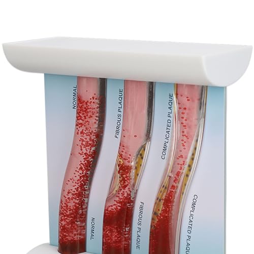 Modèle anatomique de vaisseaux LDL pour expliquer le cholestérol en consultation - 5