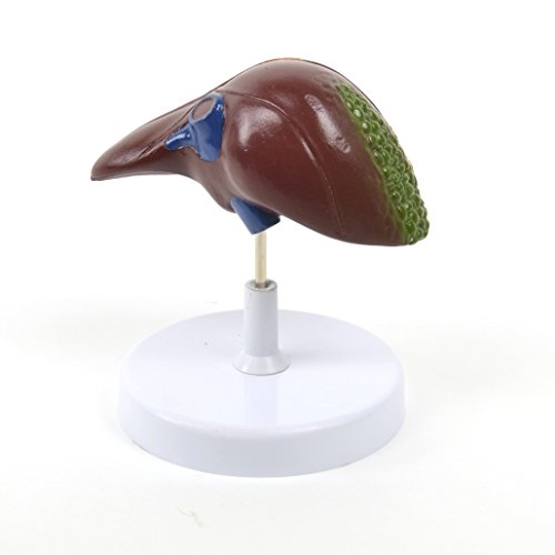 Preisvergleich Produktbild HeineScientific Modell der Lebererkrankungen