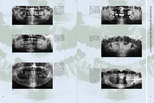 Atlante Di Radiologia Odontoiatrica. A Fini Diagnostici - 7