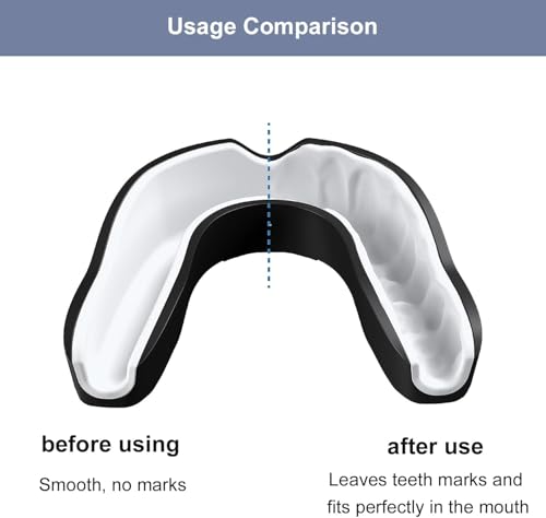 Image of DFENDER Sports Mouthguard Dual Layer Premium Protection Adults and Junior Gum Shield with Case for Boxing, MMA, Muaythai, Martial Arts, Judo and All Contact Sports