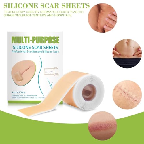 Image of VELOMIX Multipurpose Silicone Scar Sheets, Silicon gel sheets for Scars,Silicone Gel Tape for Scar Removal, Professional Scar Removal Sheets for C-Section, Surgery, Burn Protein (pack of 1)
