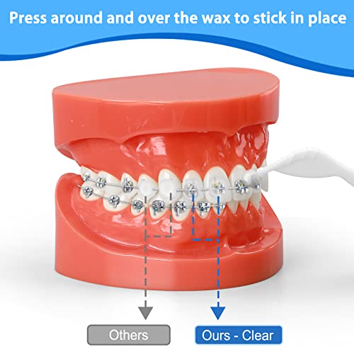 Braces Wax for Braces & Aligners- Premium Pre-cut Orthodontic Dental Wax Strips(350+ Dots), Food-Grade,Long-Lasting Hold, Incl. Blue Cases, Storage Box & Applicator Tools(Mint w/Aloe Vera & Vitamin E)