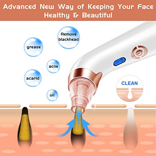 Blackhead Remover Pore Vacuum - Electric Blackhead Vacuum Cleaner Blackhead Extractor Tool Device Comedo Removal Suction Beauty Device for Women(Rose Gold)