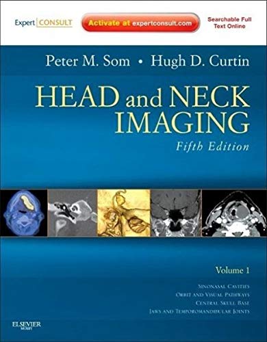Head and Neck Imaging - 2 Volume Set Expert Consult- Online and Print