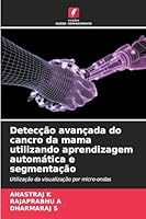 Detecção avançada do cancro da mama utilizando aprendizagem automática e segmentação (Portuguese Edition) 6202418745 Book Cover