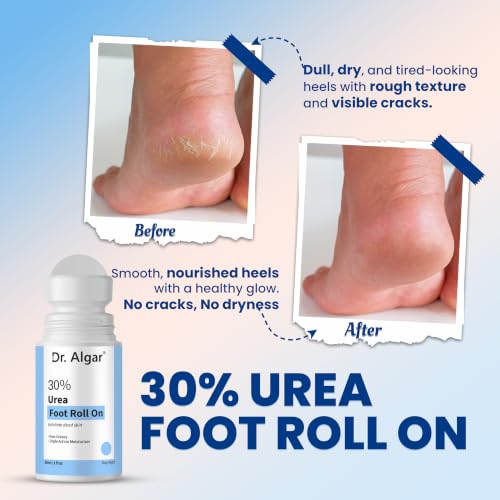 Image of Dr. Algar 30% Urea Foot Roll On for Dry & Cracked Heels | Intensive Moisturizing Foot Care | Softens Rough Skin & Calluses | Fast Absorbing Heel Repair Formula | 50 ML | Pack of 3