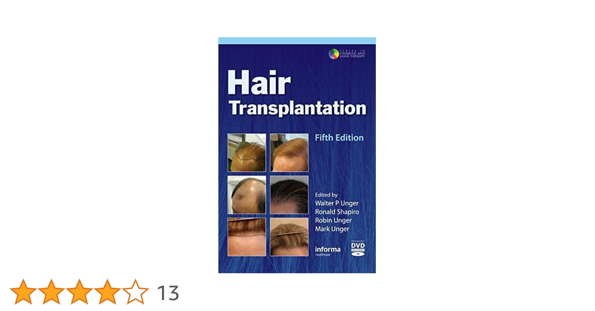 Buy Hair Transplantation Book Online at Low Prices in India