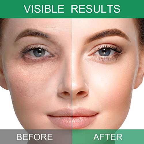 Umeantobee Under Eye Patches For Dark Circles And Puffiness, 24 Pairs Green Tea Eye Masks Anti-Aging Hydrating Skin Care For Eye Bags,Puffy Eyes,Wrinkles With Collagen Eye Pad For Women Men #TOP3