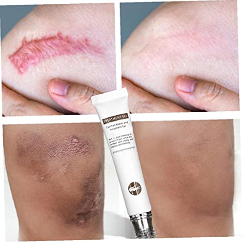Littekenverwijdering Cream Acne Markeringen Remover Gel Skin Reparatie Burns Acne Spots Behandeling Optimale Restauratie… - Image 5