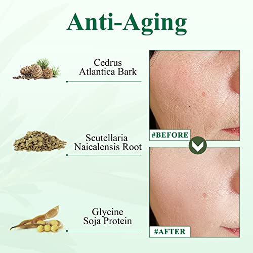 Tea Tree Oil Serum, Breylee Acne Treatment For Prone Face Sensitive Skin Care, Cystic Acne Pimples Scars Remover, Redness Relief, Niacinamide Facial Moisturizer, Anti Aging Essence, 30Ml/1.01Fl Oz #TOP4