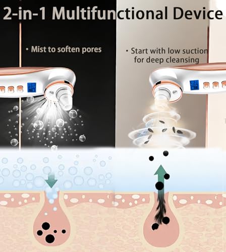 Blackhead Remover Pore Vacuum, Pore Cleaner for Face with 5 Attachments and 3 Suction Leve - image 2