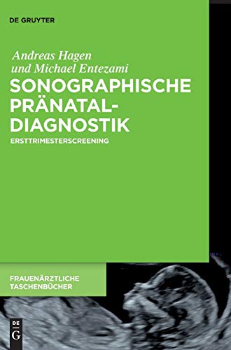 Sonographische Pränataldiagnostik: Ersttrimesterscreening (Frauenärztliche Taschenbücher) Sonographische Pränataldiagnostik: Ersttrimesterscreening (Frauenärztliche Taschenbücher)