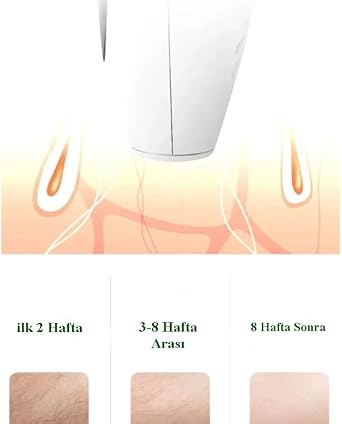 Painless Ipl Ice Laser Hair Removal Device 999.999 Flash Throw Full Body - Face