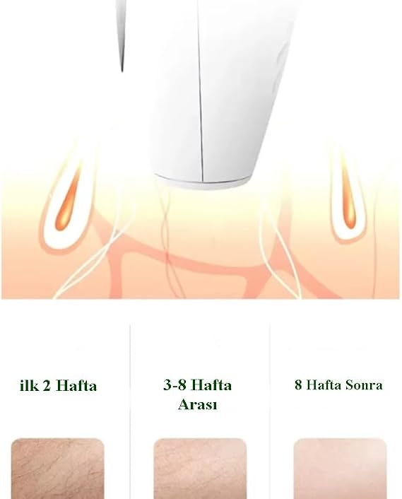 Painless Ipl Ice Laser Hair Removal Device 999.999 Flash Throw Full Body - Face