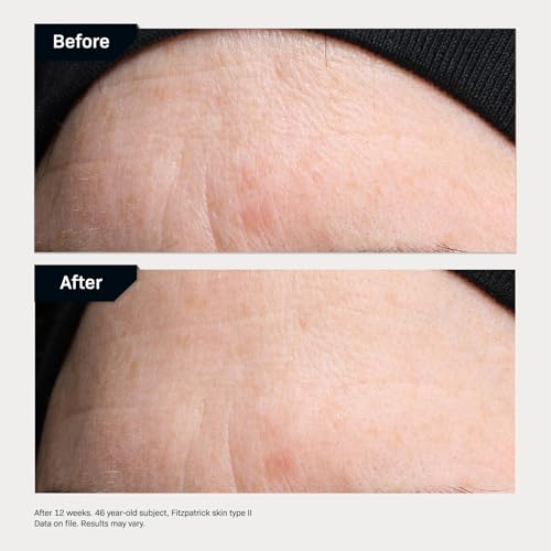 Revision Skincare Revox™ Line Relaxer, Targeted Under Eye Serum with Hyaluronic Acid, Improves Fine Lines and Wrinkles
