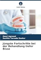 Jüngste Fortschritte bei der Behandlung tiefer Bisse (German Edition) 6208952751 Book Cover