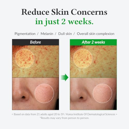 Dr.Althea Post Acne Care Set (Gentle) | 345 Relief Cream & Gentle Vitamin C Serum | Soothing Recovery, Deep Hydration, Brightening, Lightweight Texture, For All Skin Types, Vegan, Korean Skincare - Image 7