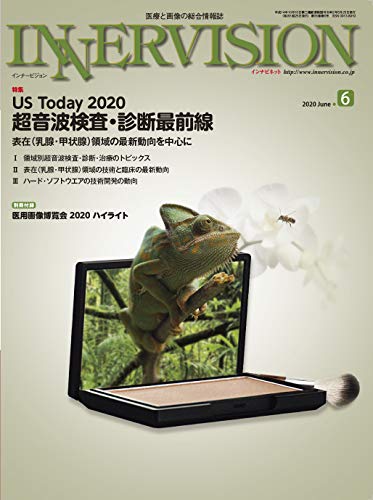無料電子書籍 アプリ 月刊インナービジョン2020年6月号 Vol.35, No.6─US Today 2020 超音波検査・診断 バイ