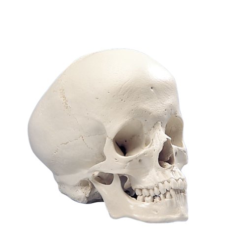 Image of 3B Scientific A29 /2 Plastic Hydrocephalic Human Skull Model, 11 inch x 9.1 inch x 7.7 inch