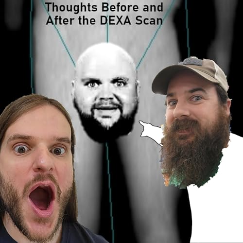 Thoughts Before and After the DEXA Scan...in Montréal Podcast Por arte de portada