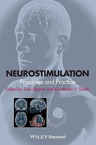 Neurostimulation: Principles and Practice view 2