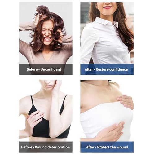 NORFULL Silicone Breast Form Mastectomy Prosthesis Waterdrop Enhancer One Piece 300g B Cup - Thumbnail 6