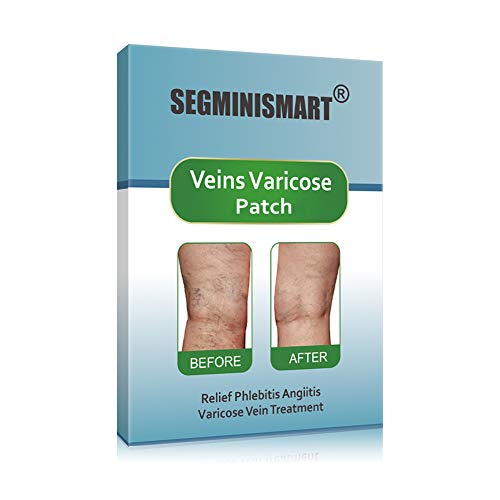 Varices Traitement,Varicose Veines -Plantes Traditionnelles- Pour Varicose Veins Efficace- Favoriser la Circulation Sanguine