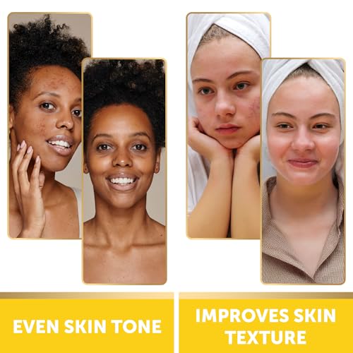 Image of VALITIC Turmeric Kojic Acid Cleansing Pads - Exfoliating Dark Spot Remover for Face with Vitamin C, Alpha Arbutin, Niacinamide and Retinol - Kojic Acid And Turmeric Cleansing Pads - 60 Units