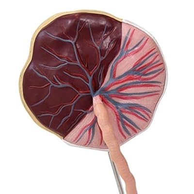 Axis Scientific Placenta Model with Removable Umbilical Cord Anatomical Model - Birthing Anatomy Model, Placenta Umbilical Cord Anatomical Model, Education for Medical School